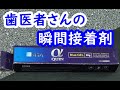 歯医者さんの瞬間接着剤で前歯つけてみた。