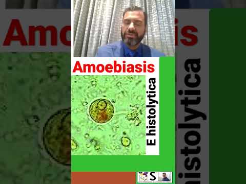 वीडियो: अमीबियासिस का इलाज कैसे करें: 13 कदम (चित्रों के साथ)