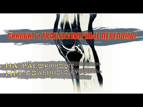 Бейне: Қара фургон аяқ киімін қалай тазартуға болады (суреттермен)