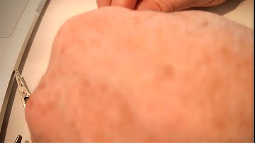 Connecting a potentiometer to Micro:Bit