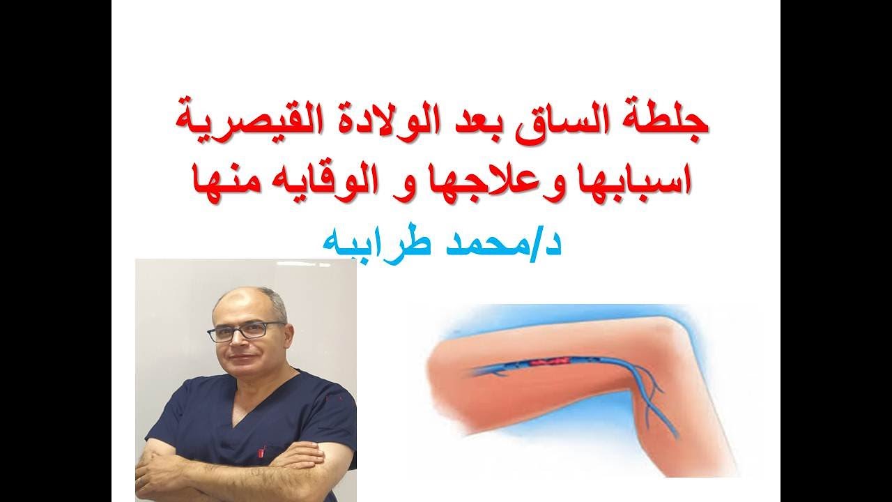 جلطة الساق بعد الولادة القيصرية أسبابها وعلاجها والوقاية منها. #دكتور_محمد_طرابيه