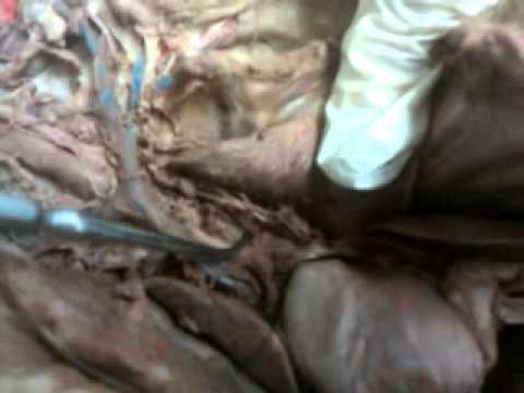 A&P 2 Lab Cat Dissection Spring 2011 - Diagram 5