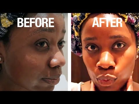 have-dry-skin?-do-this-simple-hydrating-nighttime-skin-care-routine