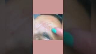 Fili tensori: viso più giovane e fresco, rimodella i tessuti in modo naturale. Scoprili! ✨