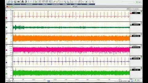 Creating Macros in Labchart