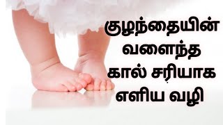 வளைந்த கால் சரியாக எளிய வழி/ bowleg for baby how to cure/ child care
