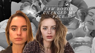 The truth on how I changed my face shape  🎀 ✨JAW BOTOX ✨🎀