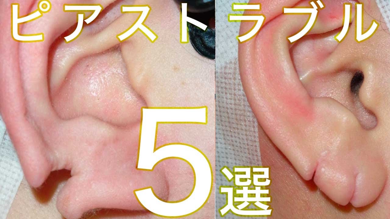 ピアス の 穴 臭い