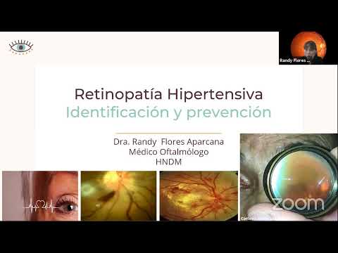 Vídeo: Angiopatía Hipertensiva De La Retina De Ambos Ojos: Que Es, Signos