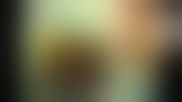 Hip Arthroscopy Part 1