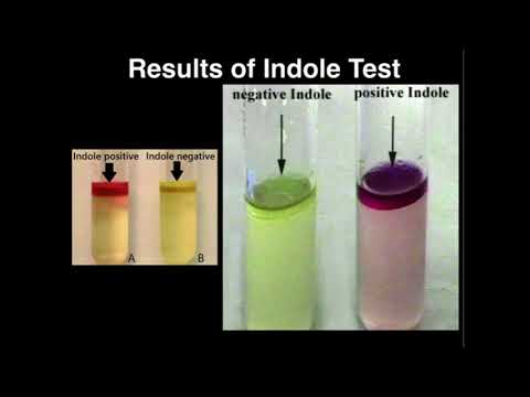 microbiology:-indole-test-(tryptophanase)