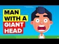 The Crazy Mystery Case of the Man With the Giant Head