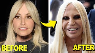 Top 20 Celebrities with TERRIBLE Plastic Surgery
