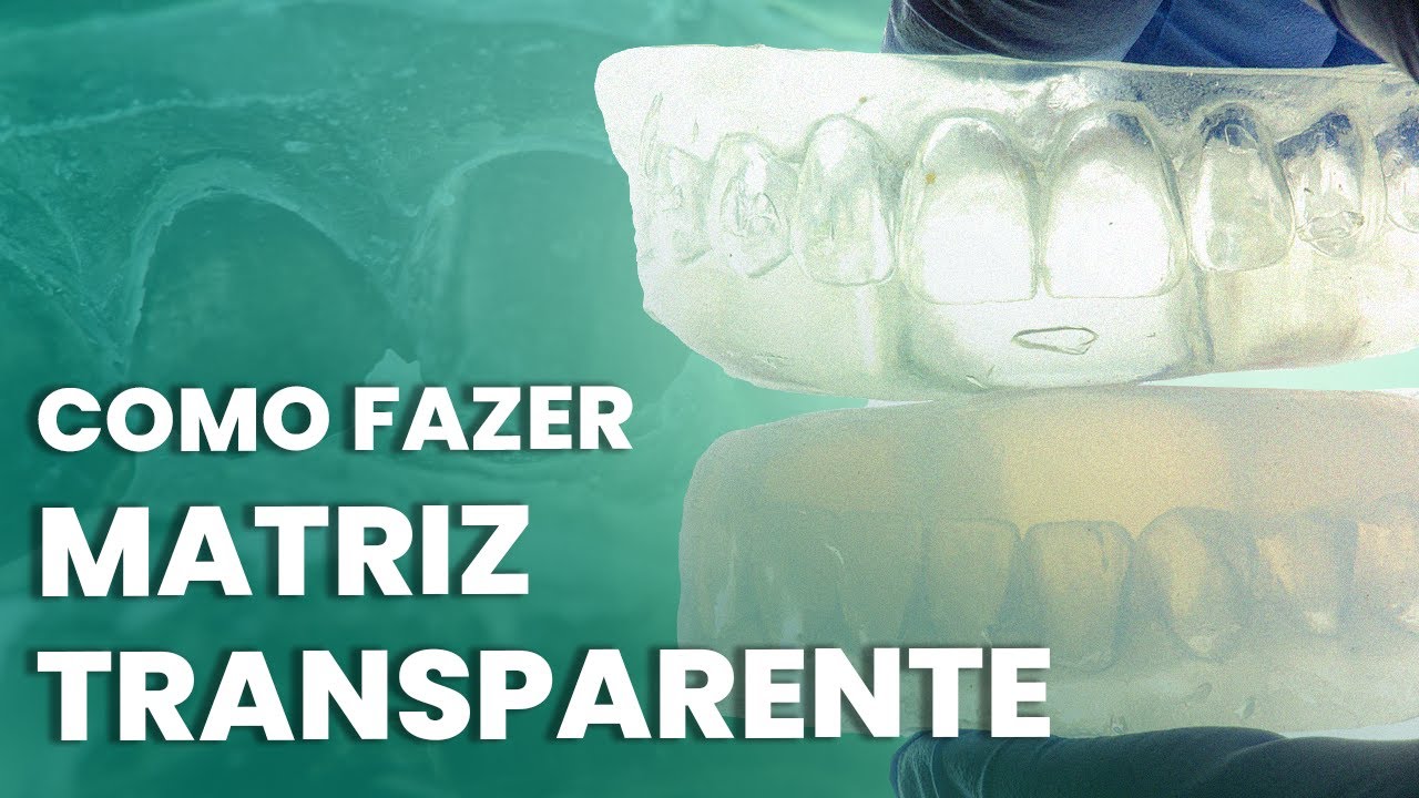 PASSO A PASSO DE COMO FAZER A MATRIZ TRANSPARETE - Mylene e Renato
