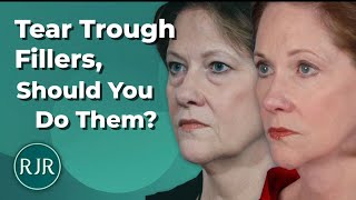 The Challenges Of Tear Trough Fillers -Dr. Rohrich