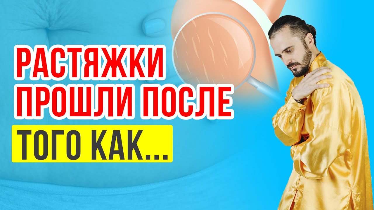 Прощайте, растяжки! Как убрать растяжки и стрии на теле в домашних ...