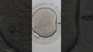 Intracytoplasmic Sperm Injection (ICSI) #ivfcenter#infertilityexpert #ivfinfertility#ivfmedication