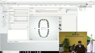 3DBioCAD - Digital Smile Design Pt.2 Model Builder for Mock-up