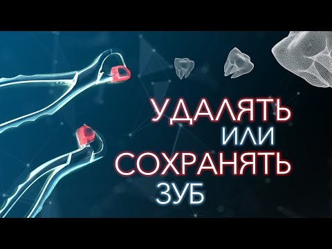 Если болит зуб. Удалять? Или лечить зуб? Отзыв врача стоматолога. Владивосток.