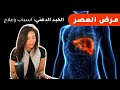السبب الخفي للكبد الدهني mp3