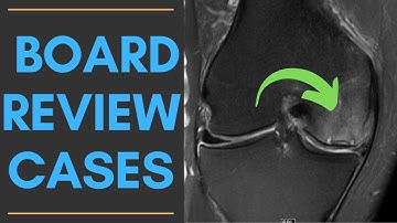 Radiology Board Review Cases | Short Radiology Cases