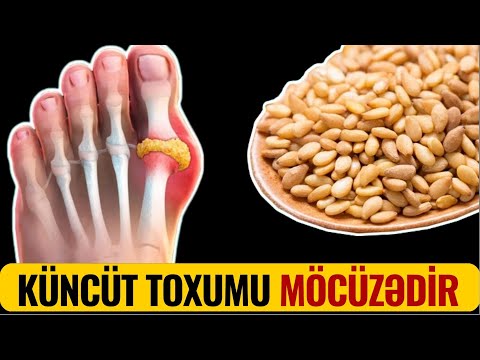 Video: Küncüt Bitkisi İstifadəsi – Küncüt Toxumu ilə Nə Etməli