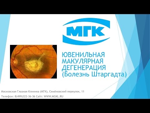 Ювенильная макулярная дегенерация (болезнь Штаргадта)