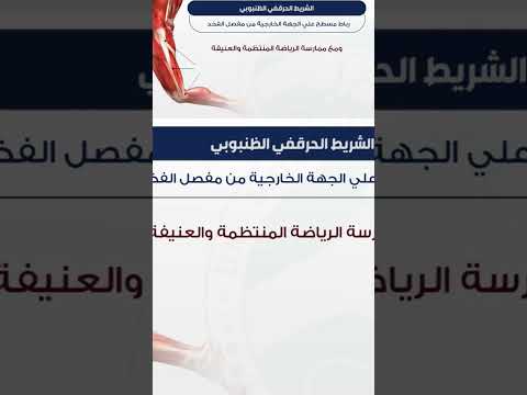 متلازمة الشريط الحرقفى الظنبوبى