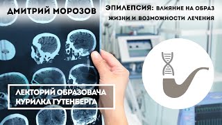 Дмитрий Морозов - Эпилепсия, влияние на образ жизни и возможности лечения(Дмитрий Морозов, врач-невролог, нейрофизиолог, эпилептолог, ассистент кафедры детской неврологии КГМА...., 2016-05-23T21:47:16.000Z)