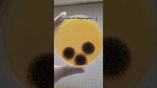 Aspergillus Species L Like, Share And Subscribe L
