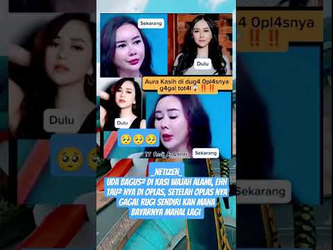 Di duga Aura Kasih gagal oplas, jadi rugi sendiri kan #short #aurakasih