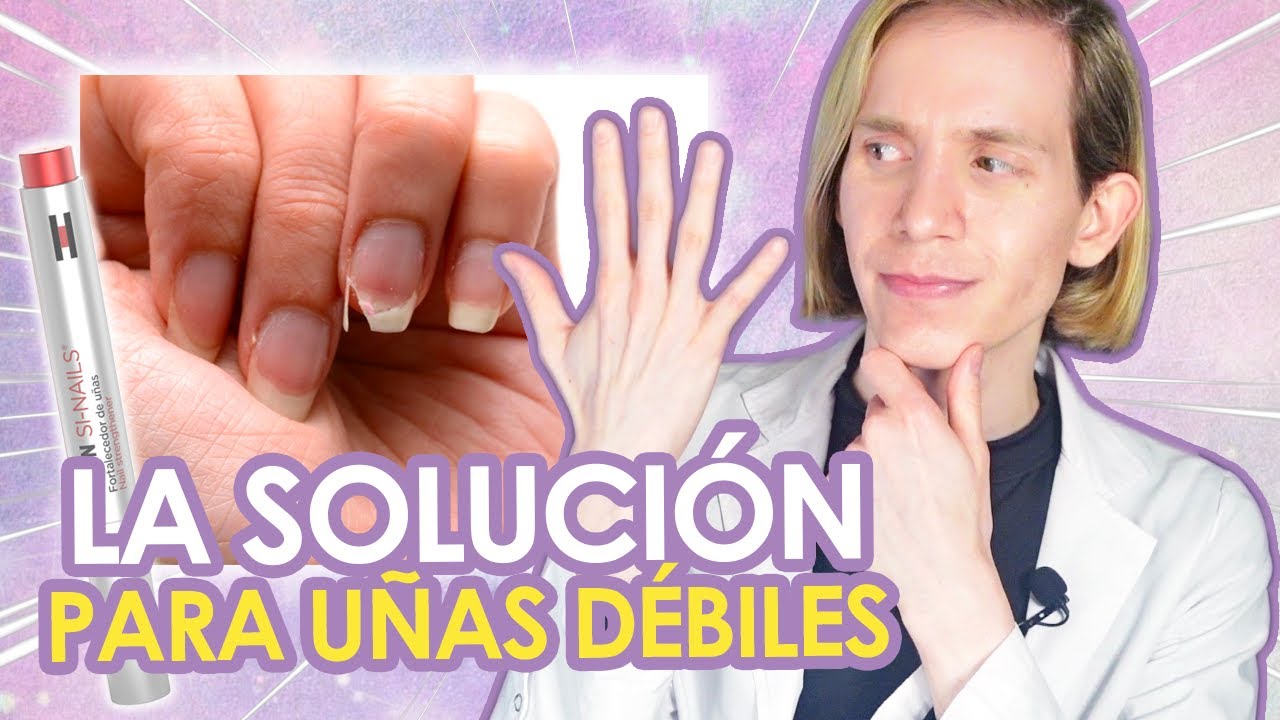 UÑAS DÉBILES: Causas y soluciones reales - COMO SOLUCIONARLAS - Simon Scarano Dermatólogo
