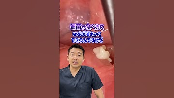 【口臭】臭い玉の正しい対処法#shorts