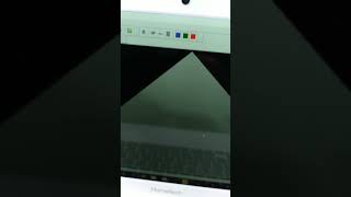 Yeni Tasarladığımız Live Scan Ve Ultrason Çekim Özelliği Olan Cihazımız