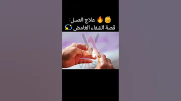 علاج العسل قصة الشفاء الغامض 