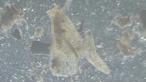 Soil Microbes: Nematodes, Microarthropods, Cillia