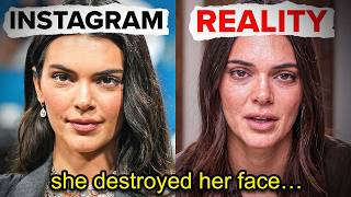 SAD TRUTH ABOUT KENDALL JENNER S FACE