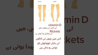 Vitamin D deficiency,symptoms, treatment, sources #viral #vitamin  @Digitalpharmaofficial