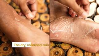 How To Use Furr Exfoliating Foot Peel Mask?