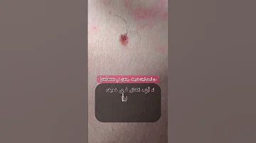 من أجمل أبيات الغزل في حبة الخال الشامة Shorts ترند اكسبلور 
