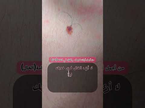 من أجمل أبيات الغزل في حبة الخال الشامة Shorts ترند اكسبلور 