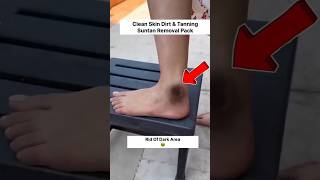 Feet whitening Tips | Clean All Dirt & Tanning | #shorts #beauty #skincare #deadskin #hack #viral