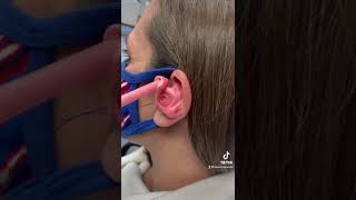 #billsmafia for the win 🤩 #earimpression #satisfying #earwax #audiologist #audiology #earwaxremoval