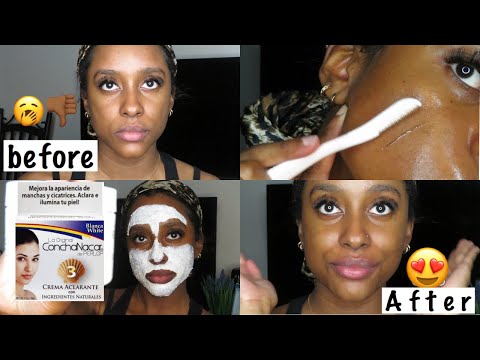 MY SKINCARE ROUTINE | Derma-planing, ConchaNacar for dark spots