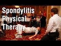 Exercise for Spondylitis Patients
