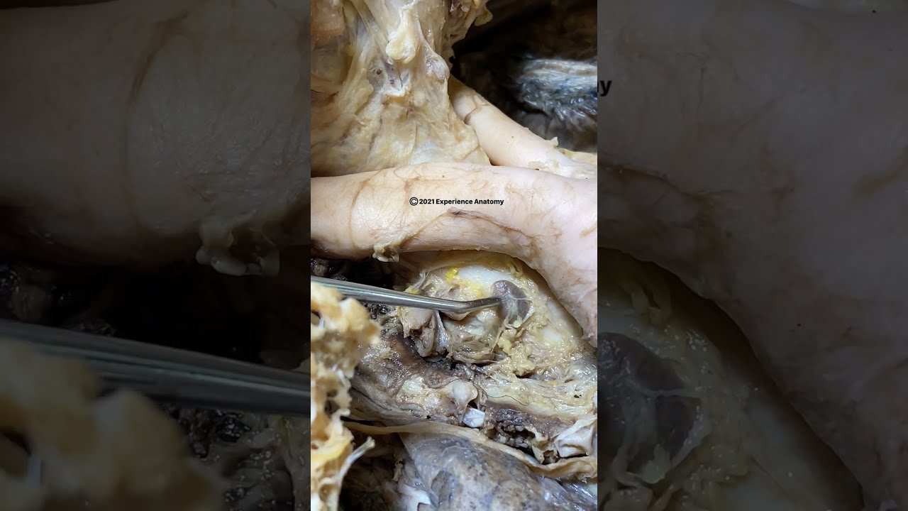 Lymph Nodes