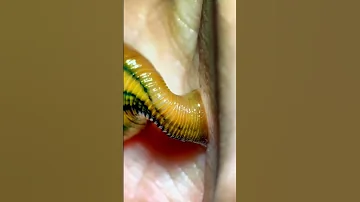 Leech Bite Under The Microscope 
