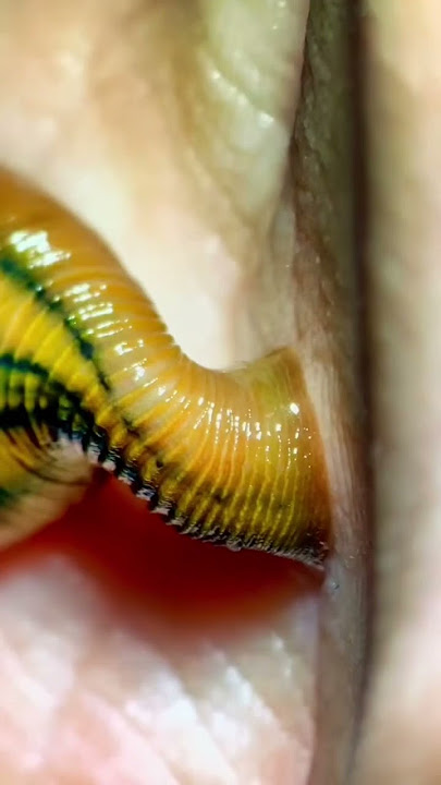 Leech bite under the microscope!