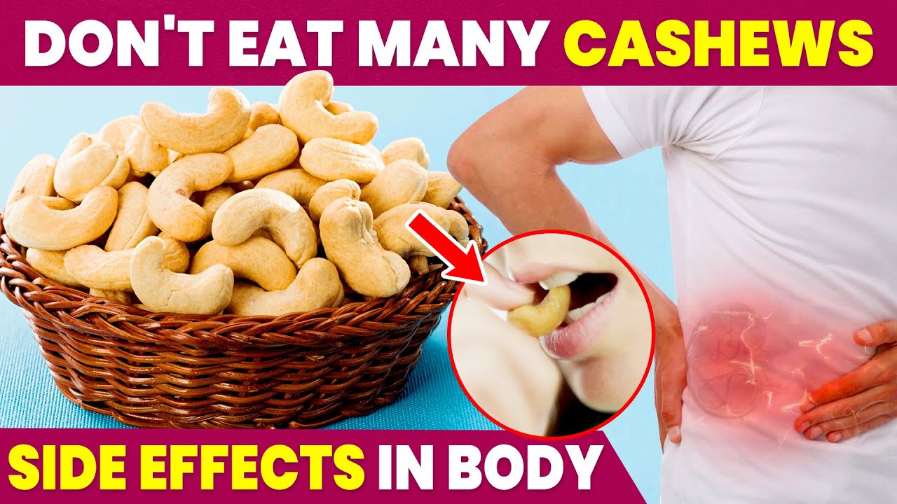 Too Many Cashews | Side Effects | Diseases Caused | Thyroid - YouTube