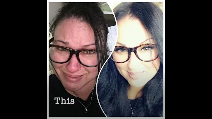 Divorce and Lichen Sclerosus